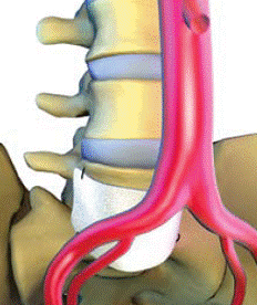 Anterior Exposure for Spine Surgery