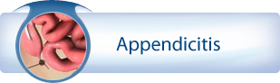 Appendicitis