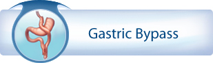 Gastric Bypass